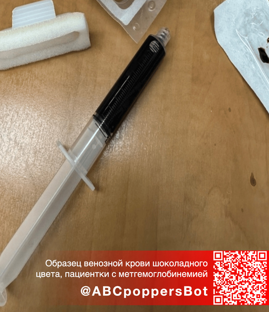 Если принять попперс внутрь в Грозном это вызывает метгемоглобинемию. Смертельное состояние Если принять попперс внутрь в Грозном это вызывает метгемоглобинемию. Смертельное состояние